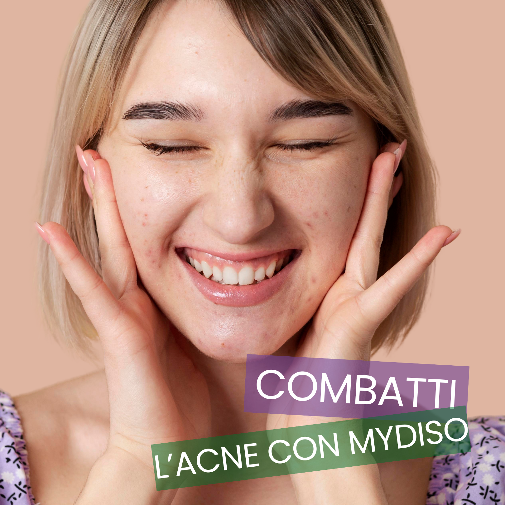 Acne - Pelle più sana e luminosa